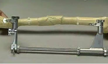 股骨頭微創手術器械富樂