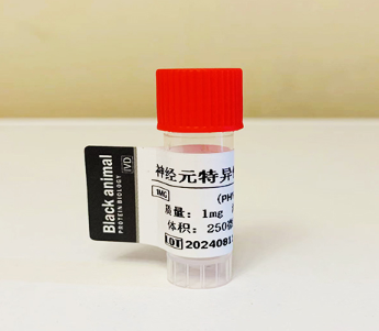 神經原烯醇化酶（nse）抗體試劑